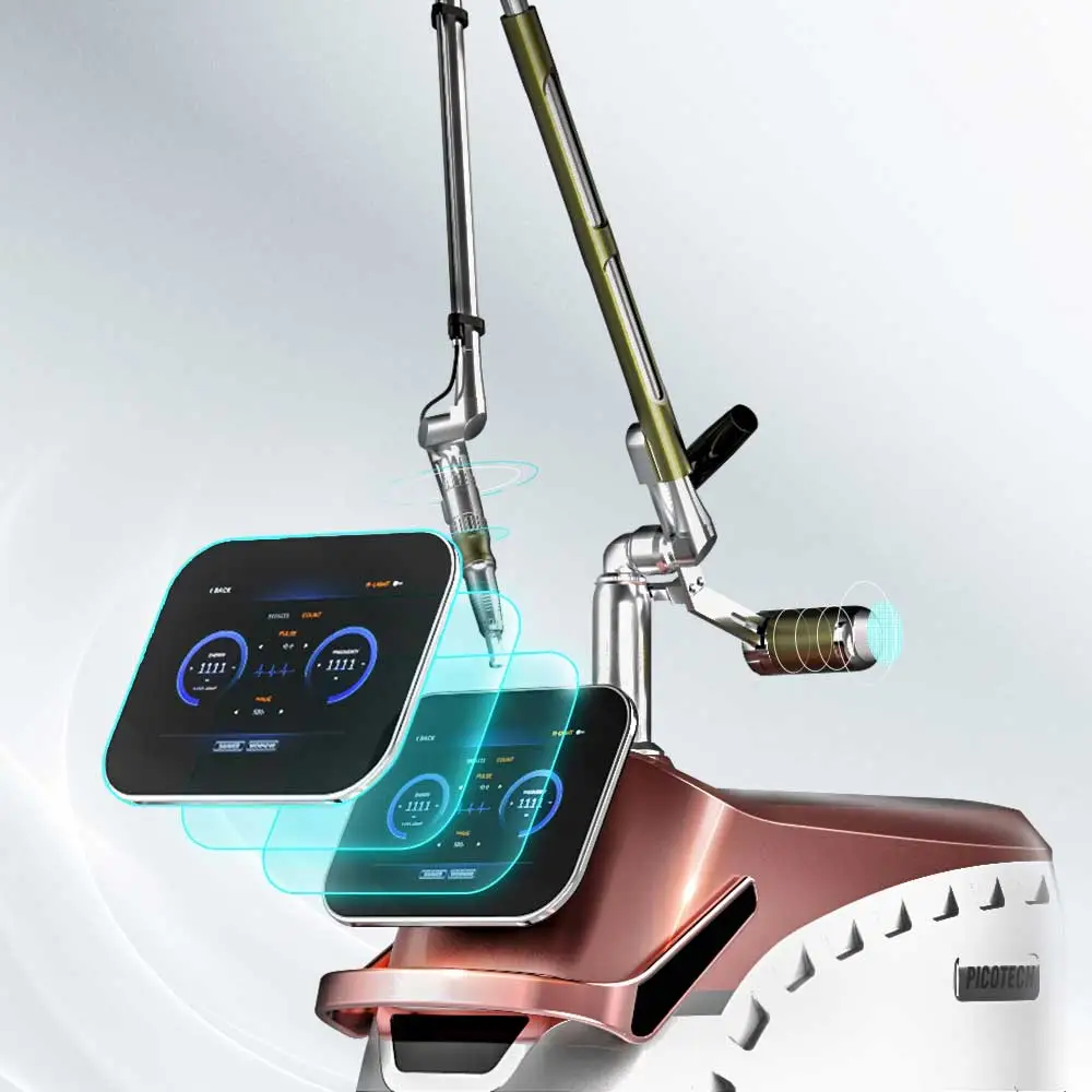 yag laser tattoo removal machine