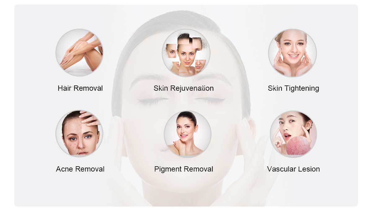 DPL Hair Removal of Manufactuers