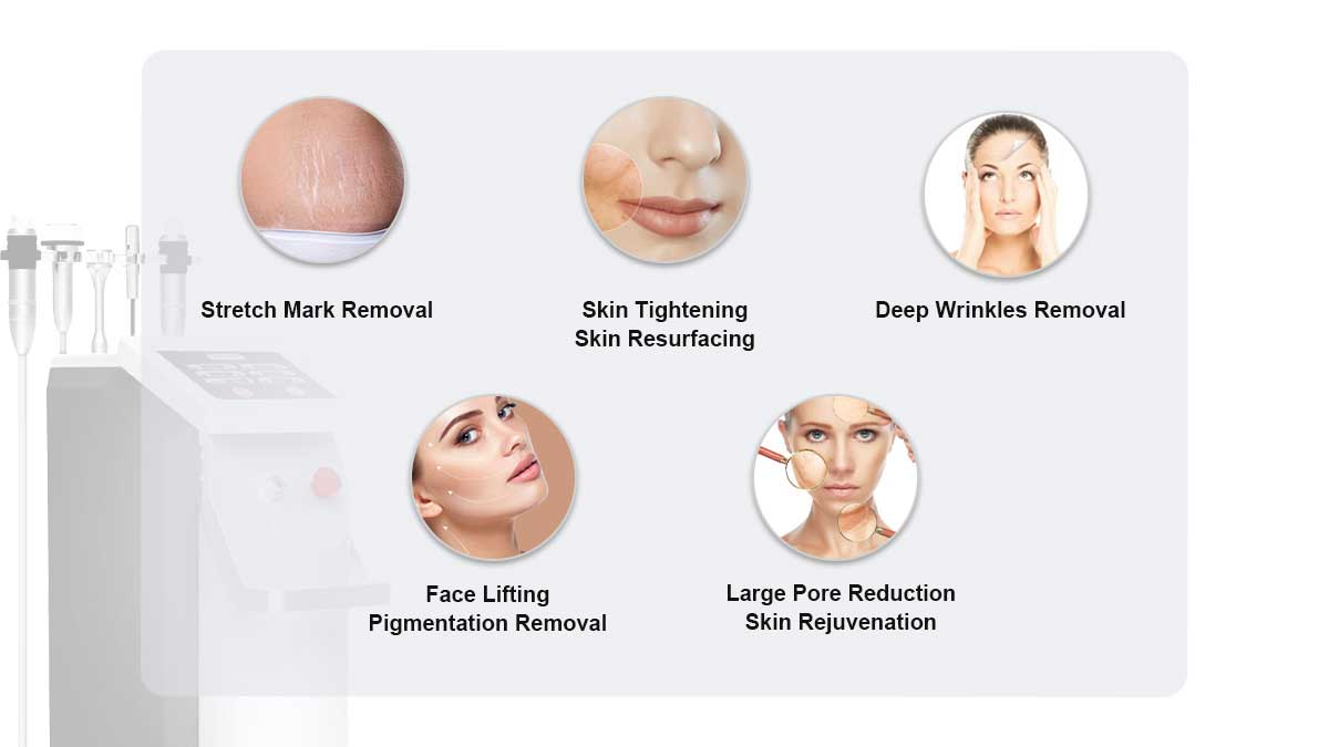 Professional Microneedling Equipment of Suppliers