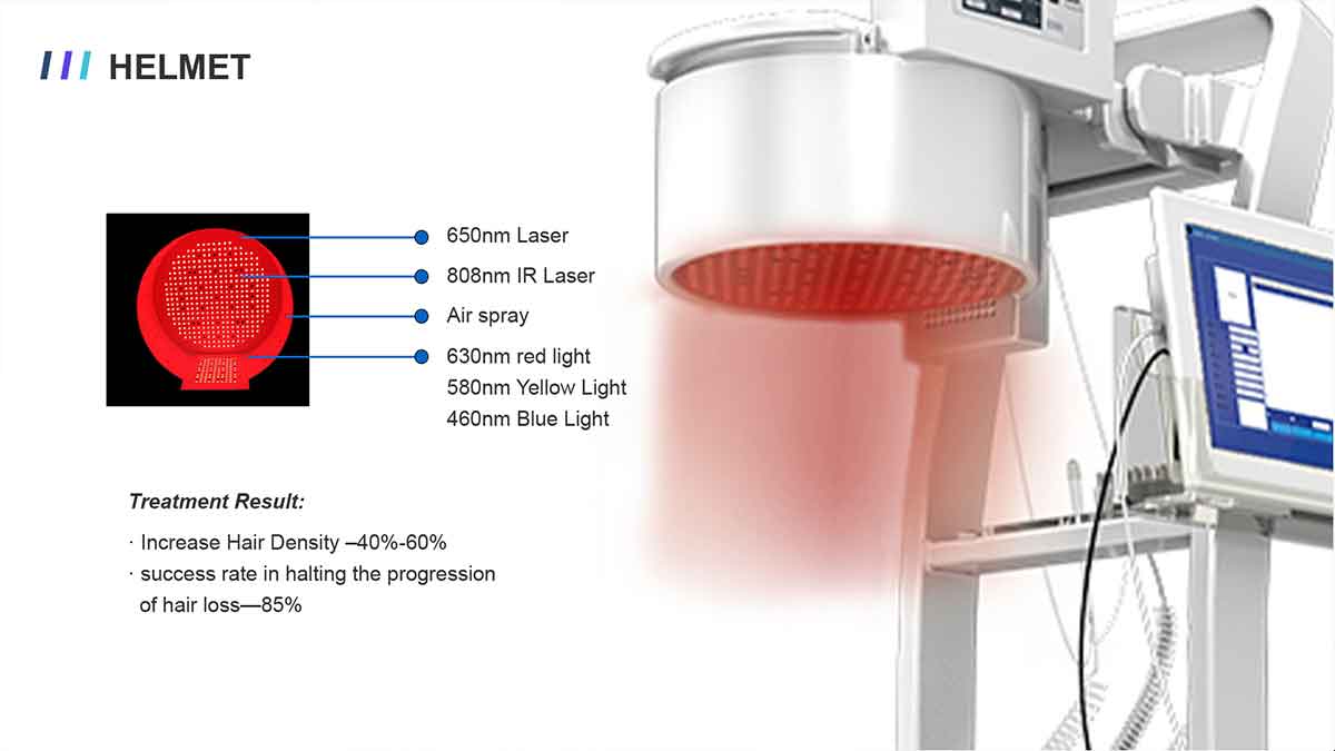 Hair Loss Treatment Machine of Company