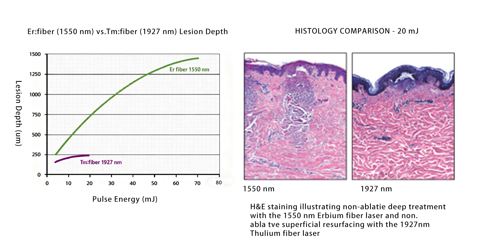 Comparative-Analysis-of-1927nm-and-1550nm-in-Treatment-Depth Comparative-Analysis-of-1927nm-and-1550nm-in-Treatment-Depth
